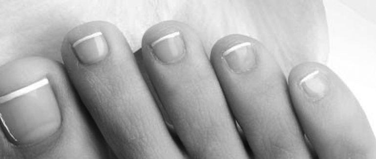 Mooie teennagels